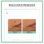 Eucerin productos dermocosméticos que cuidan la piel DERMOPURE OIL CONTROL Fluido Protector FPS30