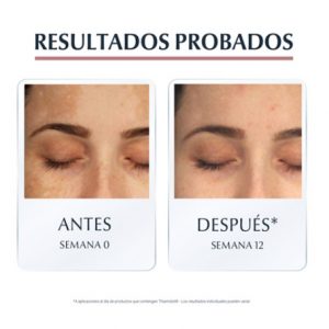 Eucerin productos dermocosméticos que cuidan la piel Anti-Pigment Dual Serum