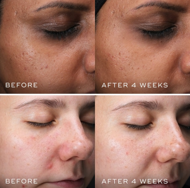 Medik8 Piel Bella de por Vida CLARITY PEPTIDES™ Suero de péptidos con 10% de niacinamida